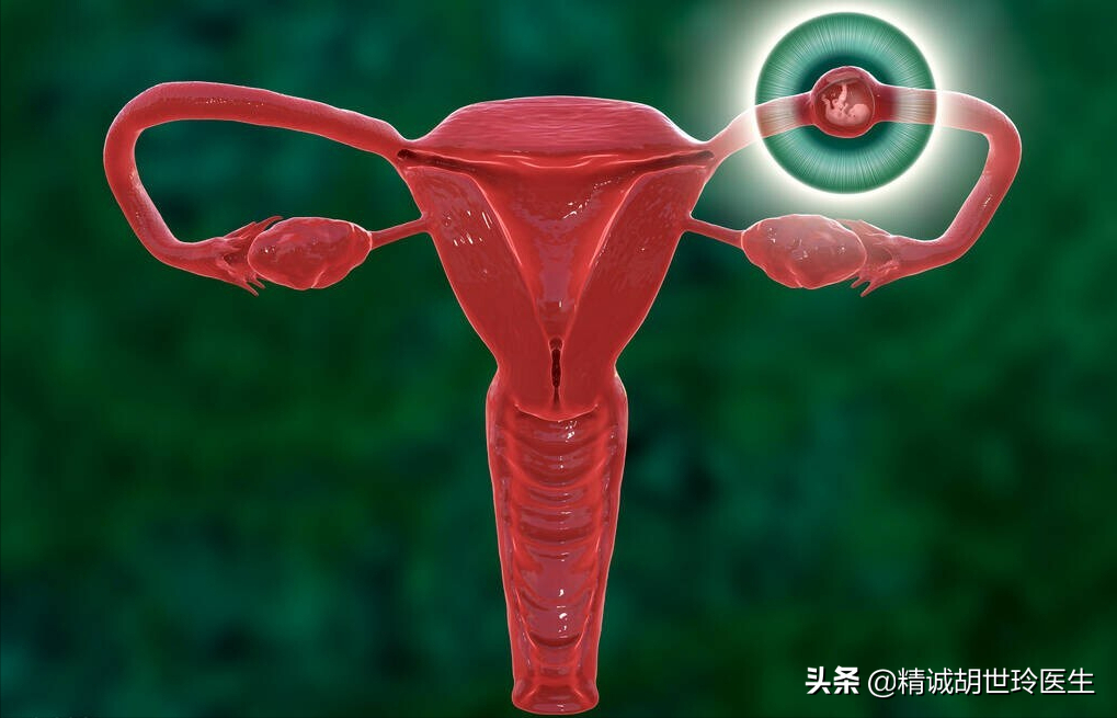 试管婴儿中遇到的专业名词解析