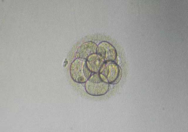 走进实验室 探秘“试管婴儿”诞生全程